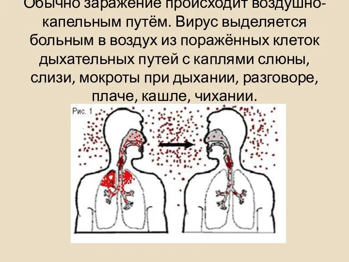 Обычно заражение происходит воздушно-капельным путём. Вирус выделяется больным в воздух из поражённых