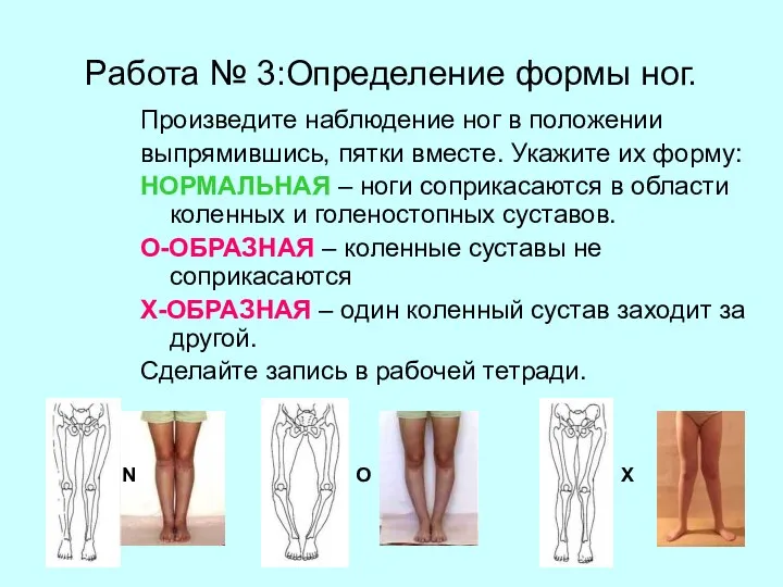 Работа № 3:Определение формы ног. Произведите наблюдение ног в положении выпрямившись, пятки