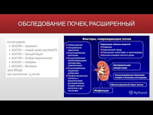 ОБСЛЕДОВАНИЕ ПОЧЕК, РАСШИРЕННЫЙ