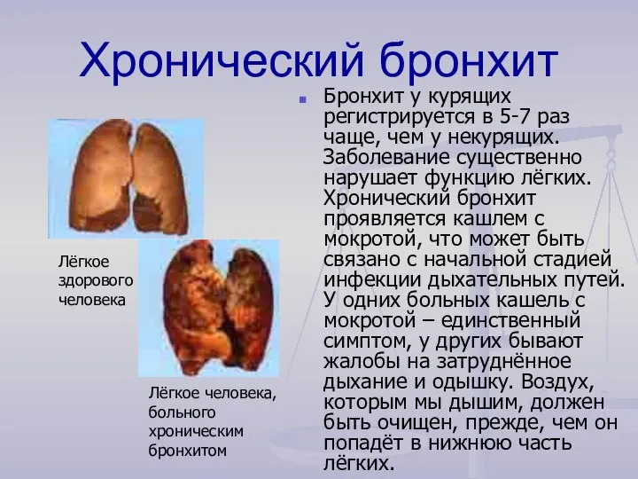 Хронический бронхит Бронхит у курящих регистрируется в 5-7 раз чаще, чем у