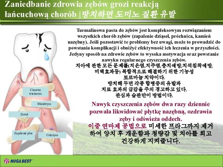 Zaniedbanie zdrowia zębów grozi reakcją łańcuchową chorób |방치하면 도미노 질환 유발 Turmalinowa