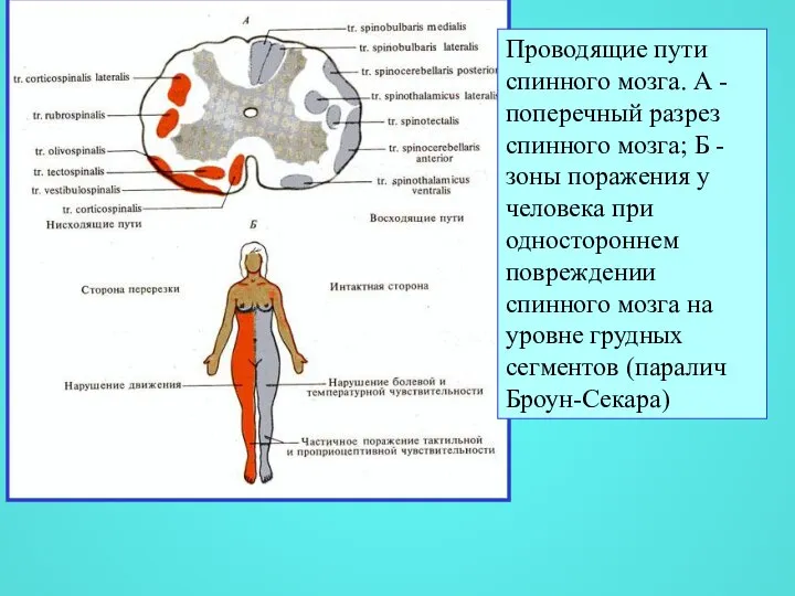 Проводящие пути спинного мозга. А - поперечный разрез спинного мозга; Б -