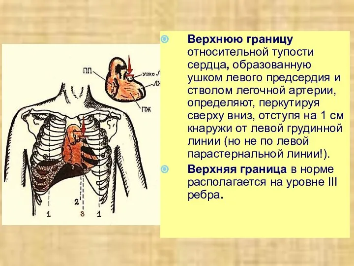 Верхнюю границу относительной тупости сердца, образованную ушком левого предсердия и стволом легочной