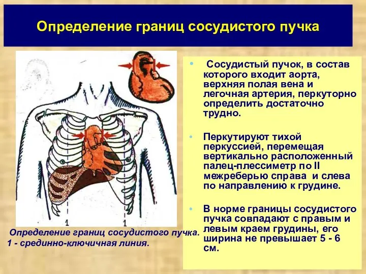 Определение границ сосудистого пучка Сосудистый пучок, в состав которого входит аорта, верхняя