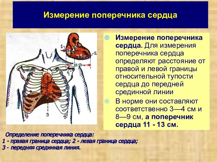 Измерение поперечника сердца Измерение поперечника сердца. Для измерения поперечника сердца определяют расстояние