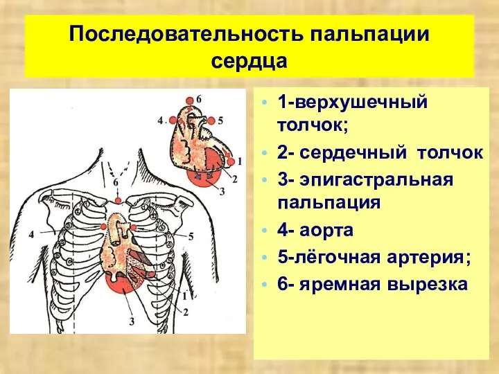 Последовательность пальпации сердца 1-верхушечный толчок; 2- сердечный толчок 3- эпигастральная пальпация 4-