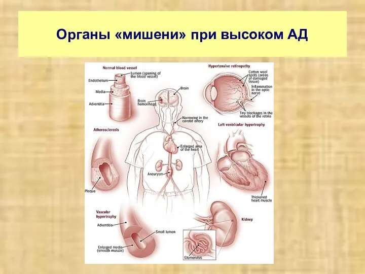 Органы «мишени» при высоком АД