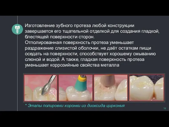 Изготовление зубного протеза любой конструкции завершается его тщательной отделкой для создания гладкой,