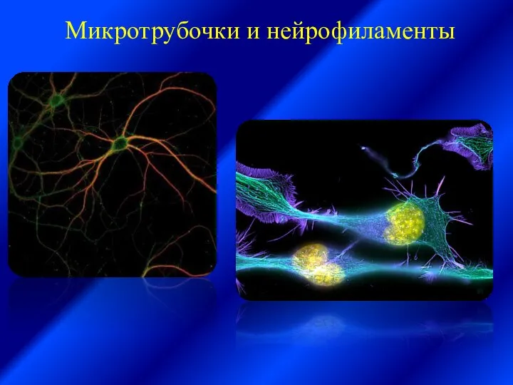 Микротрубочки и нейрофиламенты