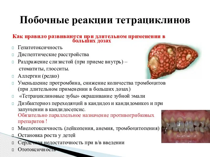 Как правило развиваются при длительном применении в больших дозах Гепатотоксичность Диспептические расстройства