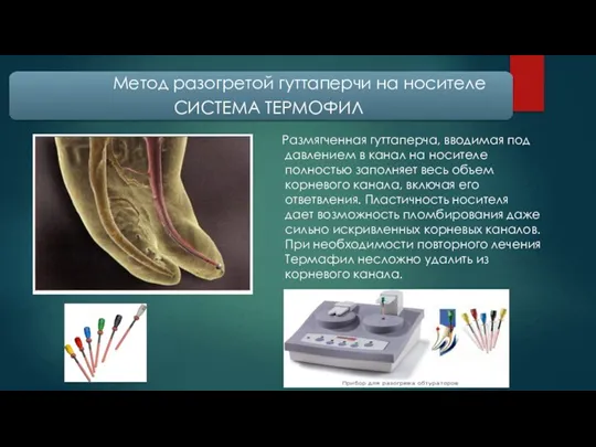 Размягченная гуттаперча, вводимая под давлением в канал на носителе полностью заполняет весь