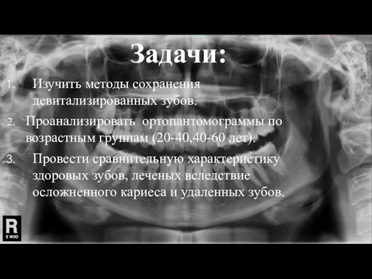 Задачи: Изучить методы сохранения девитализированных зубов. Проанализировать ортопантомограммы по возрастным группам (20-40,40-60