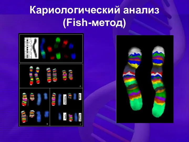 Кариологический анализ (Fish-метод)