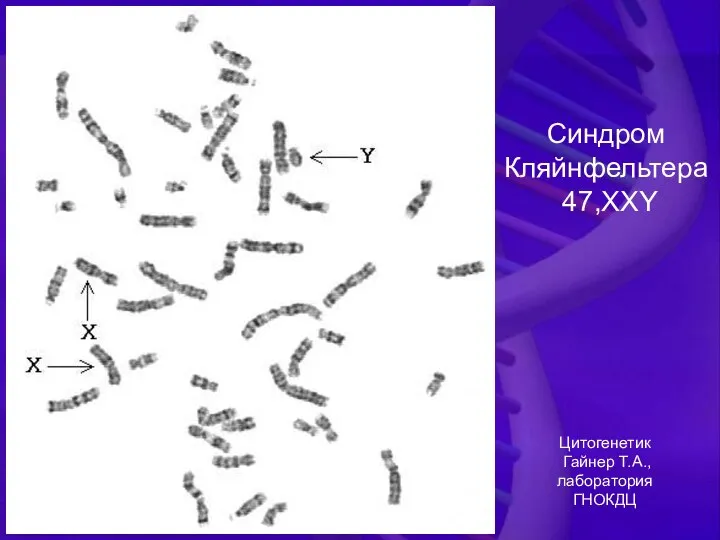 Синдром Кляйнфельтера 47,XXY Цитогенетик Гайнер Т.А., лаборатория ГНОКДЦ