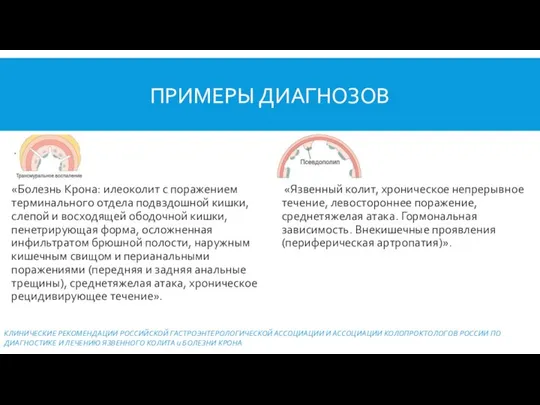 ПРИМЕРЫ ДИАГНОЗОВ «Язвенный колит, хроническое непрерывное течение, левостороннее поражение, среднетяжелая атака. Гормональная