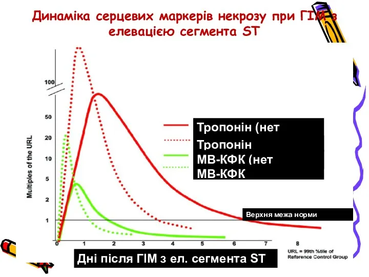 Динаміка серцевих маркерів некрозу при ГІМ з елевацією сегмента ST Тропонін (нет