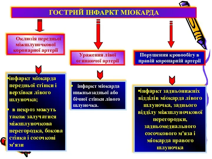 Оклюзія передньої міжшлуночкової коронарної артерії ГОСТРИЙ ІНФАРКТ МІОКАРДА Ураження лівої огинаючої артерії