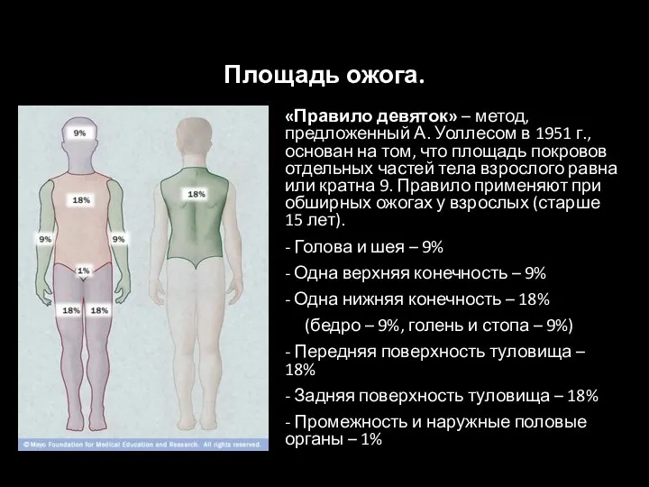 Площадь ожога. «Правило девяток» – метод, предложенный А. Уоллесом в 1951 г.,