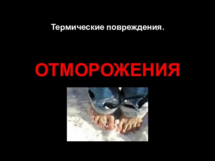 Термические повреждения. ОТМОРОЖЕНИЯ