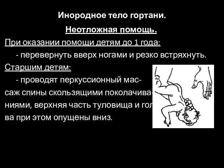 Инородное тело гортани. Неотложная помощь. При оказании помощи детям до 1 года: