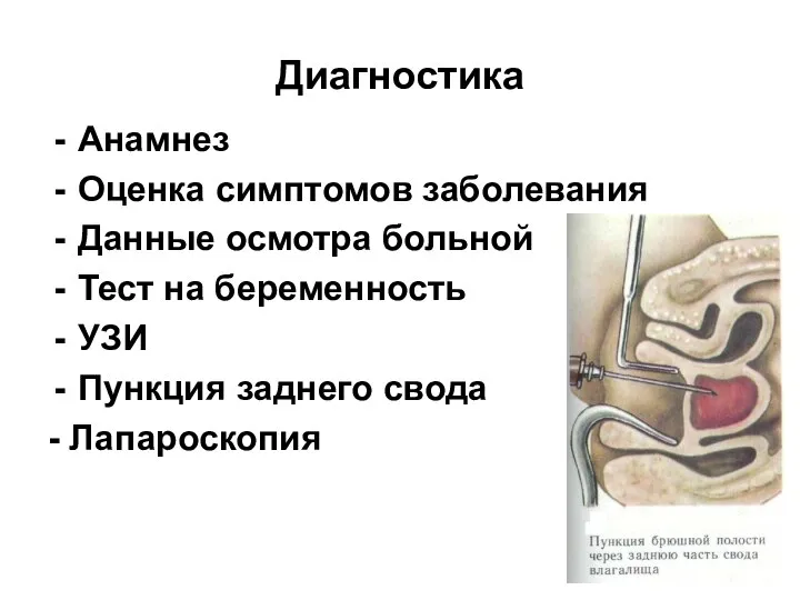 Диагностика Анамнез Оценка симптомов заболевания Данные осмотра больной Тест на беременность УЗИ