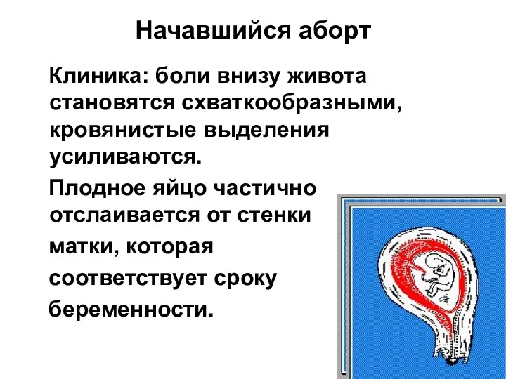 Начавшийся аборт Клиника: боли внизу живота становятся схваткообразными, кровянистые выделения усиливаются. Плодное