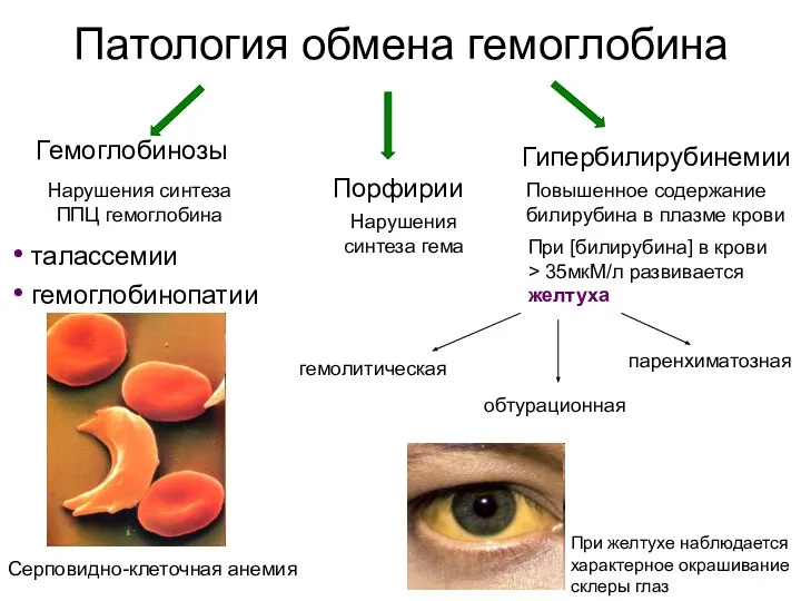 Патология обмена гемоглобина Гемоглобинозы Порфирии Гипербилирубинемии Нарушения синтеза ППЦ гемоглобина талассемии гемоглобинопатии