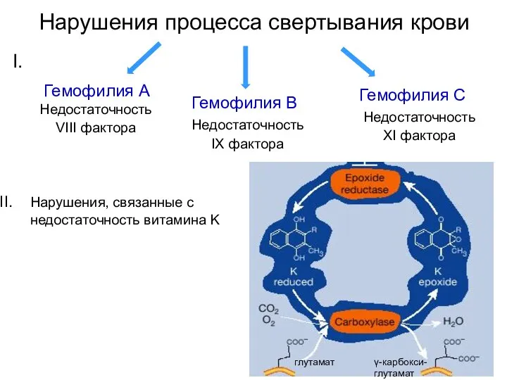 Нарушения процесса свертывания крови Гемофилия А Недостаточность VIII фактора Гемофилия В Гемофилия