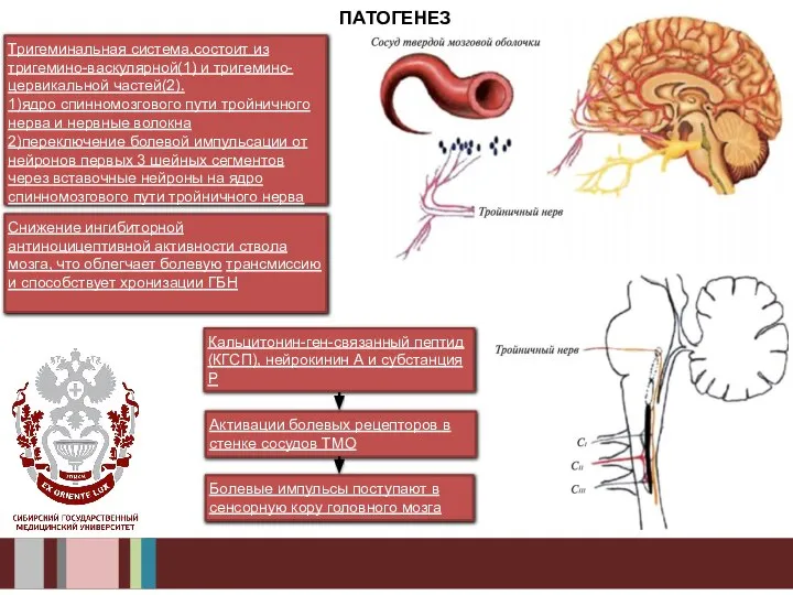 ПАТОГЕНЕЗ Тригеминальная система,состоит из тригемино-васкулярной(1) и тригемино-цервикальной частей(2). 1)ядро спинномозгового пути тройничного