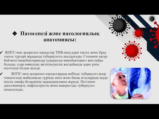 Патогенезі және патологиялық анатомиясы: ЖИТС-мен ауыратын науқастар ТМБ-ның адам тектес және бұқа