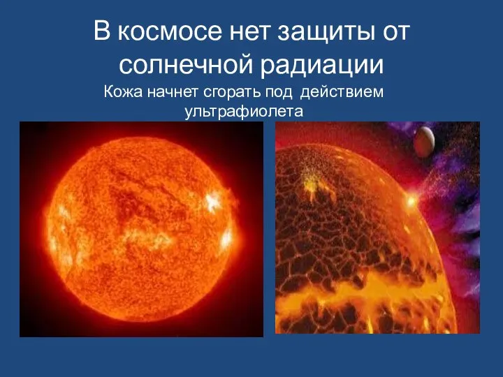 В космосе нет защиты от солнечной радиации Кожа начнет сгорать под действием ультрафиолета