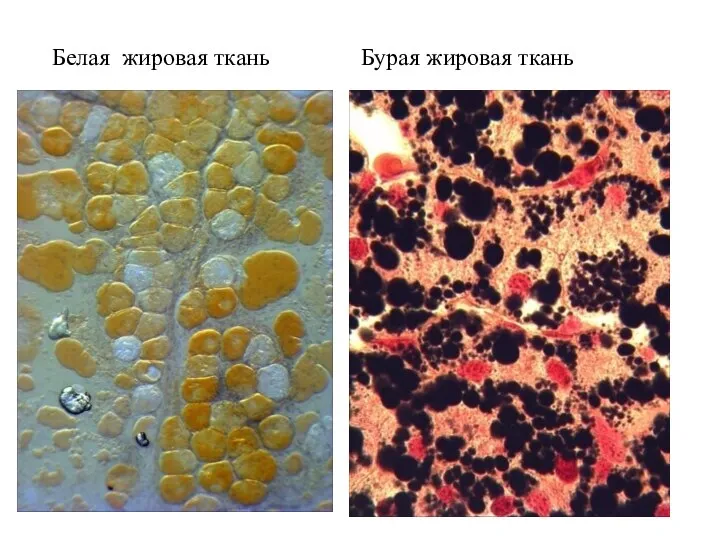 Белая жировая ткань Бурая жировая ткань