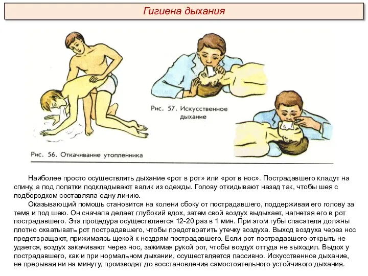 Наиболее просто осуществлять дыхание «рот в рот» или «рот в нос». Пострадавшего