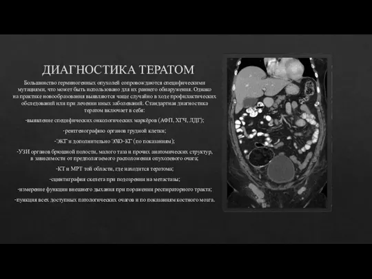 ДИАГНОСТИКА ТЕРАТОМ Большинство герминогенных опухолей сопровождаются специфическими мутациями, что может быть использовано