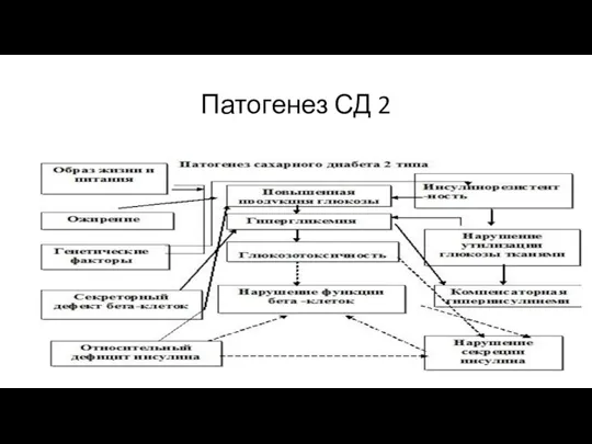 Патогенез СД 2