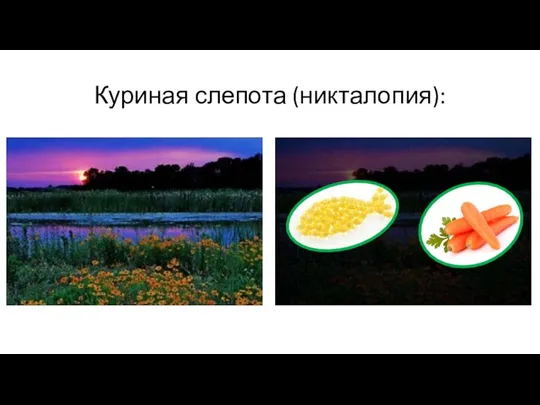 Куриная слепота (никталопия):