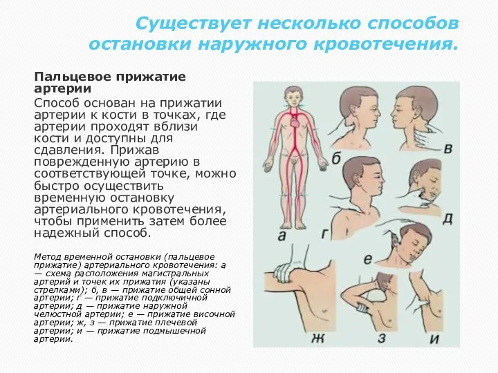 Существует несколько способов остановки наружного кровотечения. Пальцевое прижатие артерии Способ основан на