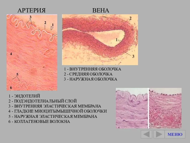 1 - ЭНДОТЕЛИЙ 2 - ПОДЭНДОТЕЛИАЛЬНЫЙ СЛОЙ 3 - ВНУТРЕННЯЯ ЭЛАСТИЧЕСКАЯ МЕМБРАНА