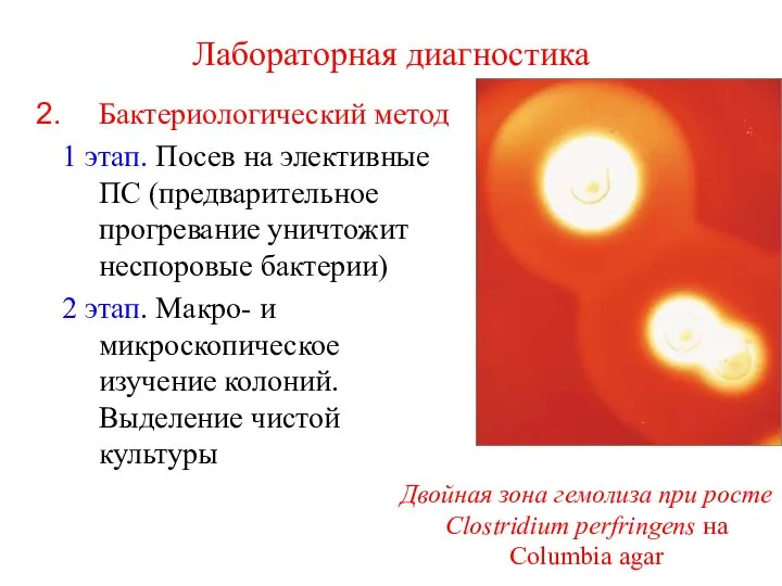 Лабораторная диагностика Бактериологический метод 1 этап. Посев на элективные ПС (предварительное прогревание