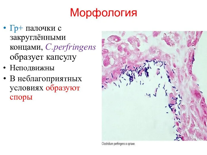 Морфология Гр+ палочки с закруглёнными концами, C.perfringens образует капсулу Неподвижны В неблагоприятных условиях образуют споры