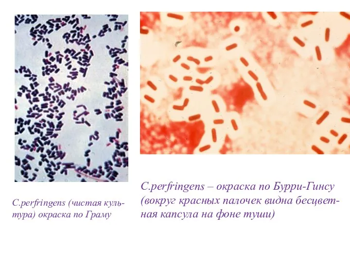 C.рerfringens (чистая куль-тура) окраска по Граму C.рerfringens – окраска по Бурри-Гинсу (вокруг