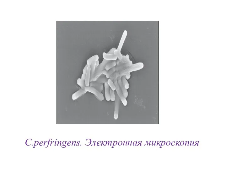 C.perfringens. Электронная микроскопия