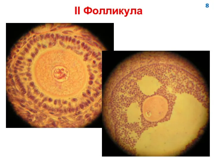 II Фолликула 8