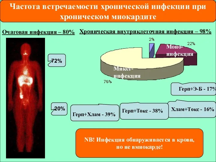 Очаговая инфекция – 80% Хроническая внутриклеточная инфекция – 98% Микст-инфекция Моно-инфекция 72%