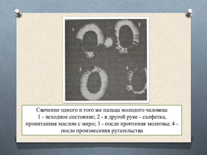 Свечение одного и того же пальца молодого человека 1 - исходное состояние;