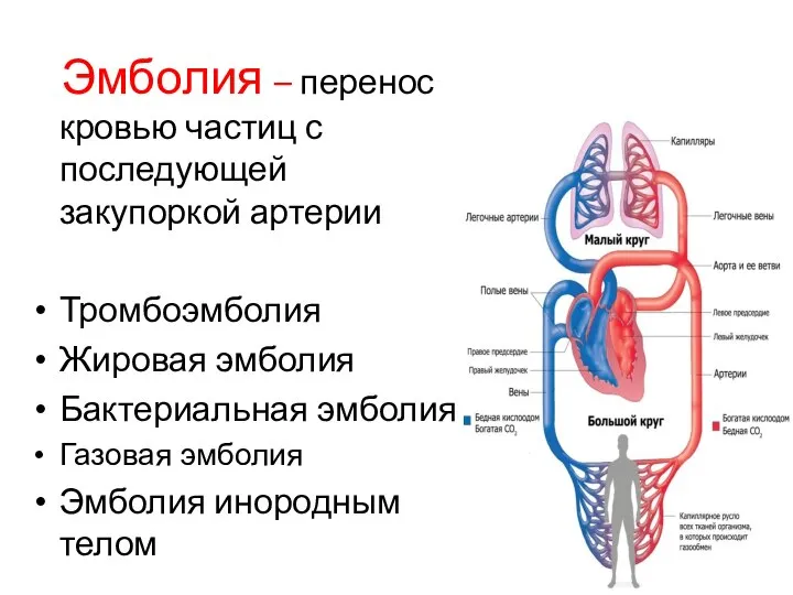 Эмболия – перенос кровью частиц с последующей закупоркой артерии Тромбоэмболия Жировая эмболия
