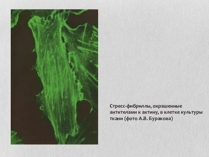 Стресс-фибриллы, окрашенные антителами к актину, в клетке культуры ткани (фото А.В. Буракова)