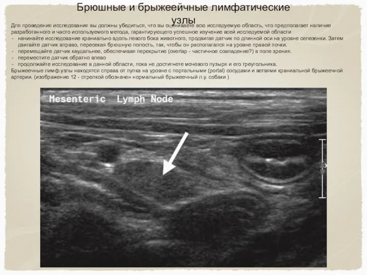 Брюшные и брыжеейчные лимфатические узлы Для проведения исследования вы должны убедиться, что