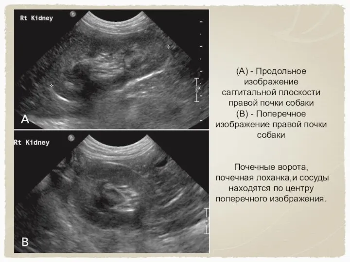 (А) - Продольное изображение саггитальной плоскости правой почки собаки (В) - Поперечное