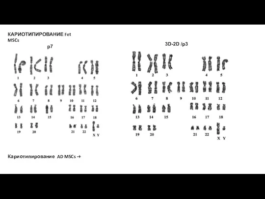 КАРИОТИПИРОВАНИЕ Fet MSCs p7 3D-2D /p3 Кариотипирование AD MSCs -+